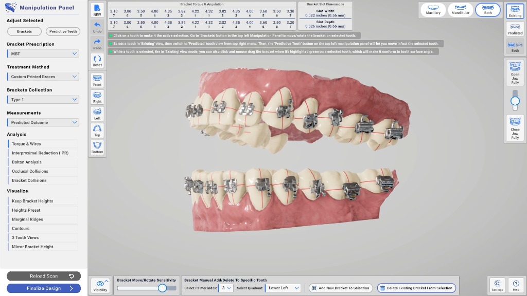 Photorealistic Metal Brackets