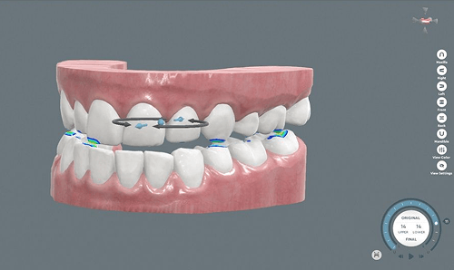 Teeth Configurator