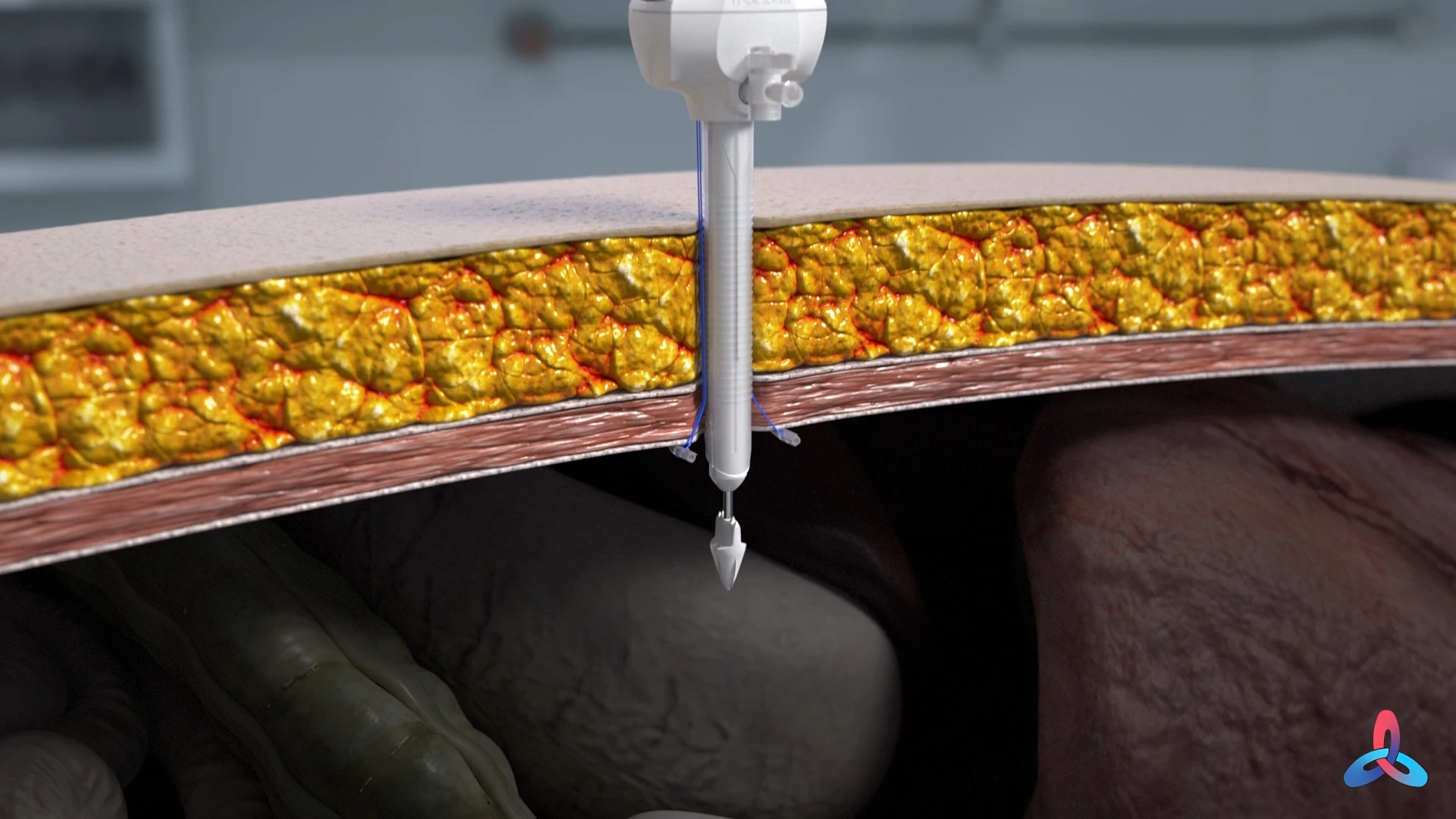 ANATOMICAL MODELING