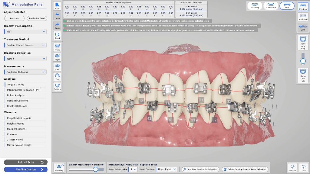 Maxillary & Mandibular Views